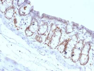 Immunohistochemistry-Paraffin: HNF-3 alpha/FoxA1 Antibody (FOXA1/1518) [NBP2-53324]