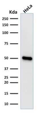 Western Blot: HNF-3 alpha/FoxA1 Antibody (FOXA1/1518) [NBP2-53324]