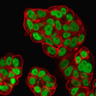 Immunocytochemistry/ Immunofluorescence: HNF-3 alpha/FoxA1 Antibody (FOXA1/1519) [NBP2-53331]