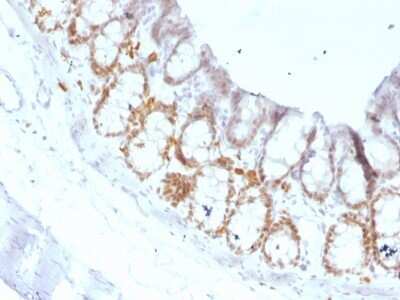 Immunohistochemistry-Paraffin: HNF-3 alpha/FoxA1 Antibody (FOXA1/1519) [NBP2-53331]