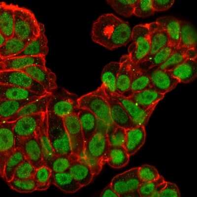 Immunocytochemistry/ Immunofluorescence: HNF-3 alpha/FoxA1 Antibody (FOXA1/2230R) - Azide and BSA Free [NBP3-08921]