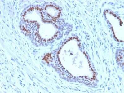 Immunohistochemistry-Paraffin: HNF-3 alpha/FoxA1 Antibody (FOXA1/2230R) - Azide and BSA Free [NBP3-08921]