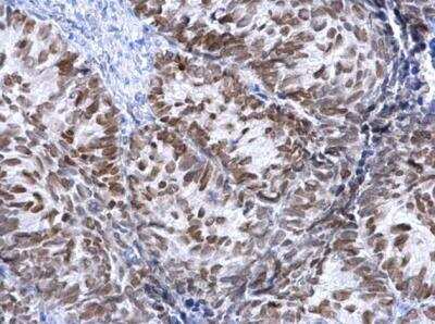 Immunohistochemistry-Paraffin: HNF-3 alpha/FoxA1 Antibody [NBP1-30877]