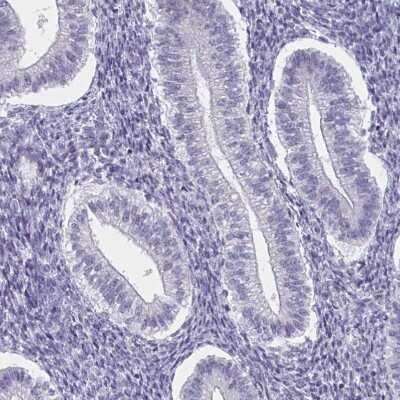 Immunohistochemistry-Paraffin: HNF-3 alpha/FoxA1 Antibody [NBP2-38628]