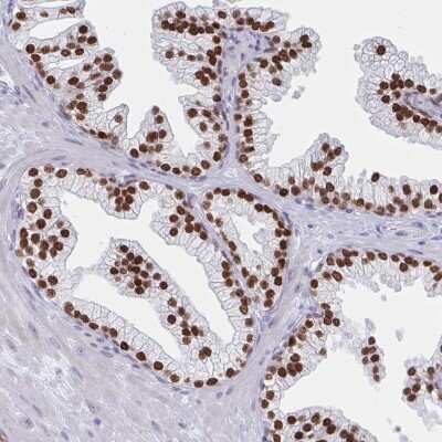 Immunohistochemistry-Paraffin: HNF-3 alpha/FoxA1 Antibody [NBP2-38628]