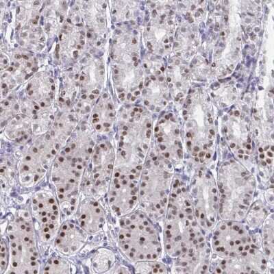 Immunohistochemistry-Paraffin: HNF-3 alpha/FoxA1 Antibody [NBP2-38628]