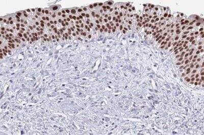 Immunohistochemistry-Paraffin: HNF-3 alpha/FoxA1 Antibody [NBP2-38628]