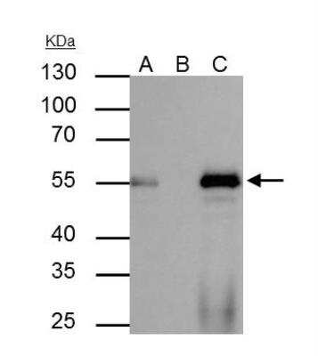 Immunoprecipitation: HNF-3 alpha/FoxA1 Antibody [NBP1-30877]