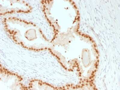 Immunohistochemistry-Paraffin: HNF-3 alpha/FoxA1 Antibody (rFOXA1/1515) - Azide and BSA Free [NBP3-08920]