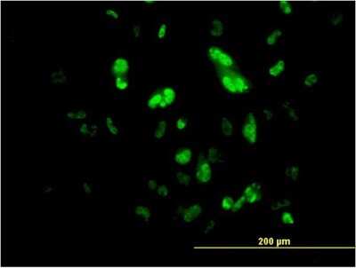 Immunocytochemistry/ Immunofluorescence: HNF-3 beta/FoxA2 Antibody (1C7) [H00003170-M10]