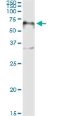 Immunoprecipitation: HNF-3 beta/FoxA2 Antibody (1C7) [H00003170-M10]