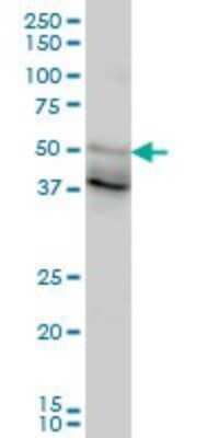 Western Blot: HNF-3 beta/FoxA2 Antibody (1C7) [H00003170-M10]