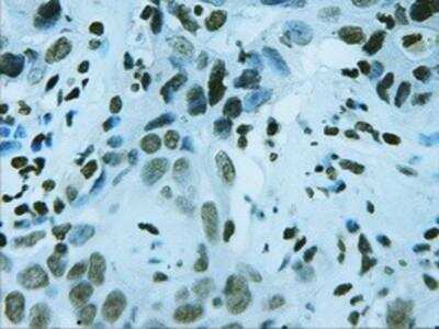 Immunohistochemistry-Paraffin: HNF-3 beta/FoxA2 Antibody (OTI3C10) [NBP2-02088]