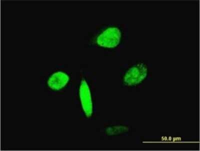 Immunocytochemistry/ Immunofluorescence: HNF-3 beta/FoxA2 Antibody (6C12) [H00003170-M12]