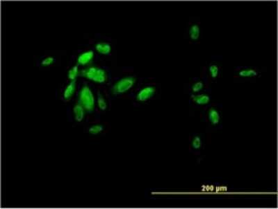 Immunocytochemistry/ Immunofluorescence: HNF-3 beta/FoxA2 Antibody (7E6) [H00003170-M01]