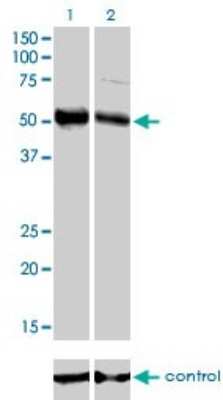Western Blot: HNF-3 beta/FoxA2 Antibody (7E6) [H00003170-M01]