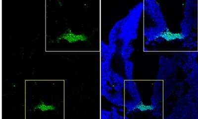 Immunohistochemistry-Frozen: HNF-3 beta/FoxA2 Antibody [NBP1-30966]