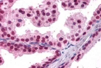 Immunohistochemistry-Paraffin: HNF-3 beta/FoxA2 Antibody [NB100-1263]