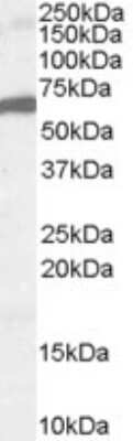 Western Blot: HNF-3 beta/FoxA2 Antibody [NB100-1263]