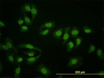 Immunocytochemistry/ Immunofluorescence: HNF-4 alpha/NR2A1 Antibody (4E2) [H00003172-M04]