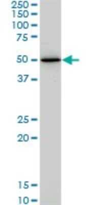 Western Blot: HNF-4 alpha/NR2A1 Antibody (4E2) [H00003172-M04]