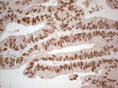 Immunohistochemistry: HNF-4 alpha/NR2A1 Antibody (OTI2H2) - Azide and BSA Free [NBP2-70905]