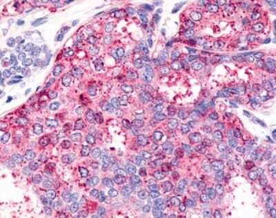 Immunohistochemistry-Paraffin: HNF-4 gamma/NR2A2 Antibody - BSA Free [NLS5162]