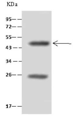 Immunoprecipitation: HNF-4 gamma/NR2A2 Antibody [NBP2-98899]