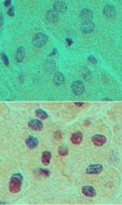 Immunohistochemistry-Paraffin: HNF-6/ONECUT1 Antibody [NBP2-27079]
