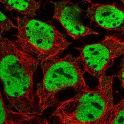 Immunocytochemistry/ Immunofluorescence: HNF1 Antibody [NBP2-38243]