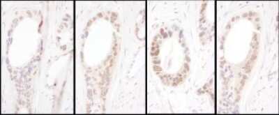 Immunohistochemistry: HNF1 Antibody [NBP2-32124]