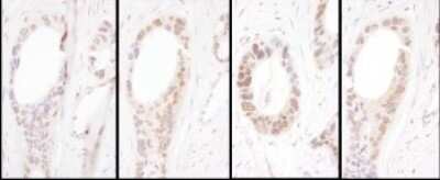 Immunohistochemistry: HNF1 Antibody [NBP2-32125]