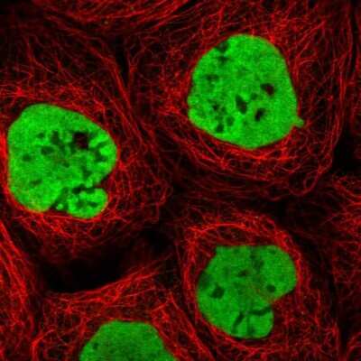 Immunocytochemistry/ Immunofluorescence: HNRNPA0 Antibody [NBP1-83240]