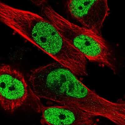 Immunocytochemistry/ Immunofluorescence: HNRNPA0 Antibody [NBP2-55847]