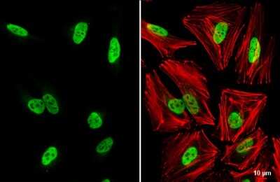 Immunocytochemistry/ Immunofluorescence: HNRNPA0 Antibody [NBP3-13222]