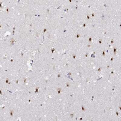 Immunohistochemistry-Paraffin: HNRNPA0 Antibody [NBP2-55847]