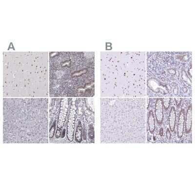 Immunohistochemistry-Paraffin: HNRNPA0 Antibody [NBP2-55847]