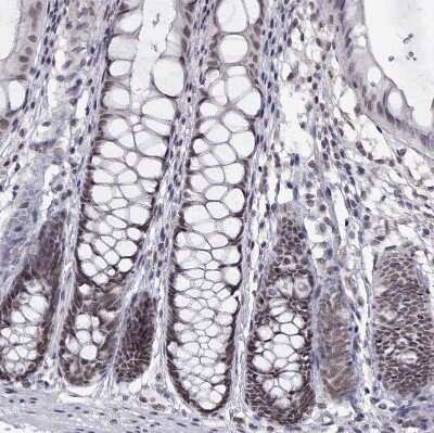 Immunohistochemistry-Paraffin: HNRNPA0 Antibody [NBP2-55847]