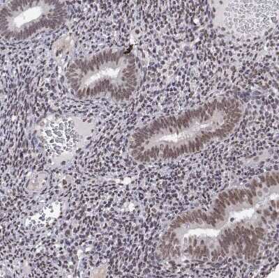 Immunohistochemistry-Paraffin: HNRNPA0 Antibody [NBP2-55847]