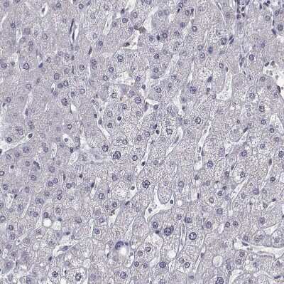 Immunohistochemistry-Paraffin: HNRNPA0 Antibody [NBP2-55847]