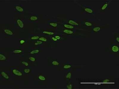 Immunocytochemistry/ Immunofluorescence: HNRNPUL1 Antibody [H00011100-B01P]
