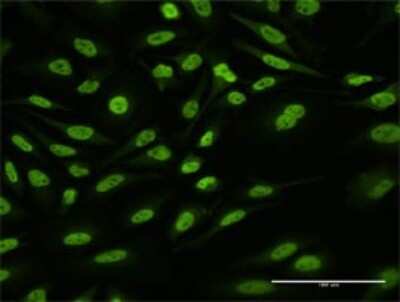 Immunocytochemistry/ Immunofluorescence: HNRNPUL1 Antibody [H00011100-D01P]