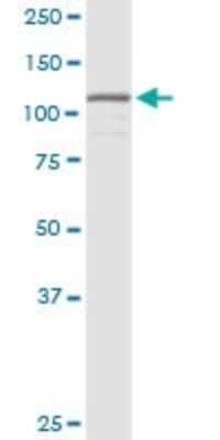 Western Blot: HNRNPUL1 Antibody [H00011100-D01P]