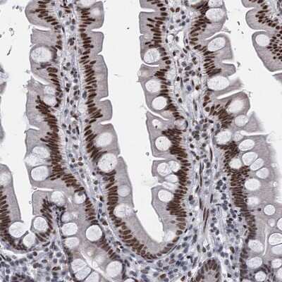 Immunohistochemistry-Paraffin: HNRNPUL2 Antibody [NBP1-92001]