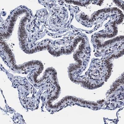 Immunohistochemistry-Paraffin: HNRNPUL2 Antibody [NBP1-92001]
