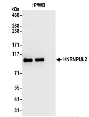 Immunoprecipitation: HNRNPUL2 Antibody [NBP2-37687]