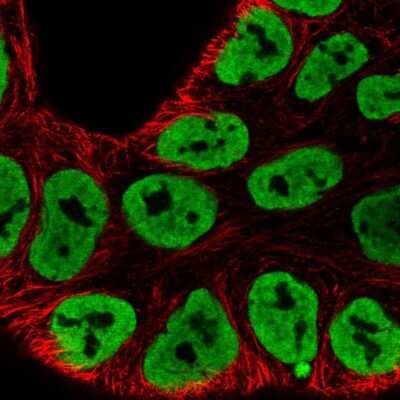 Immunocytochemistry/ Immunofluorescence: HNRPA3 Antibody [NBP2-56989]
