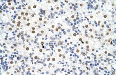 Immunohistochemistry: HNRPA3 Antibody [NBP1-80486]
