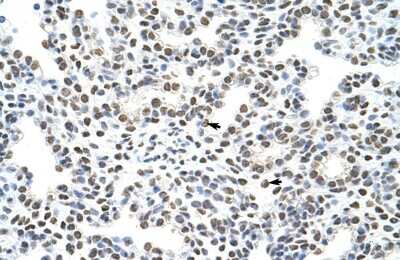 Immunohistochemistry-Paraffin: HNRPA3 Antibody [NBP1-80486]