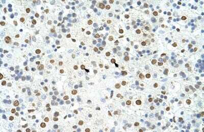 Immunohistochemistry-Paraffin: HNRPA3 Antibody [NBP1-80487]